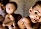 भारत में 33 लाख बच्चे कुपोषित